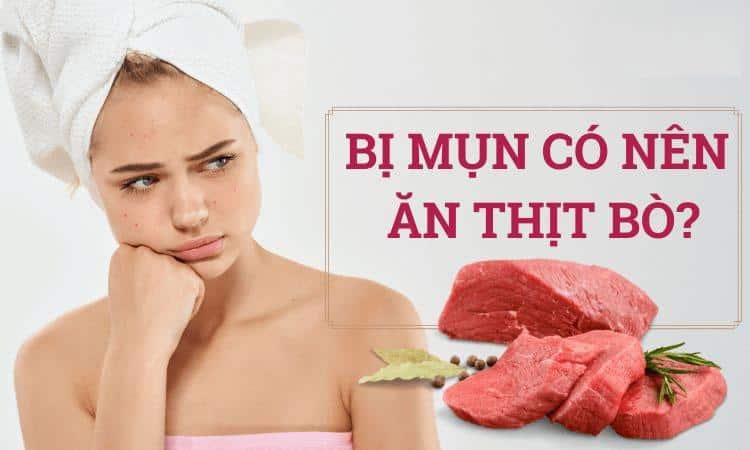 Tại sao bị mụn không nên ăn thịt bò?